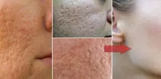 how to get rid of pores reduce large open pores