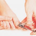 how to treat a torn toenail