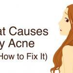 what causes body acne