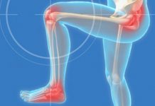 Home Remedies for Joint Pain and Arthritis