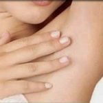 How to Get Rid of Dark Underarms