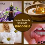 Home Remedies to Treat Mucocele Naturally