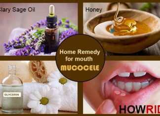 Home Remedies to Treat Mucocele Naturally