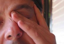 how to get rid of itchy eyes