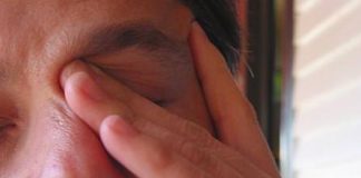 how to get rid of itchy eyes
