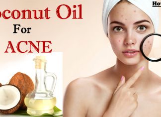 Coconut Oil for Acne