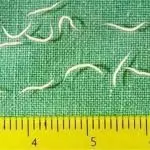 Coconut oil and apple cider vinegar for pinworms