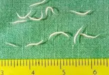 Coconut Oil And Apple Cider Vinegar For Pinworms Coconut oil and apple cider vinegar for pinworms