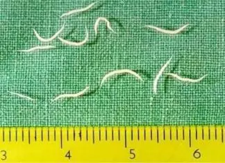 Coconut oil and apple cider vinegar for pinworms