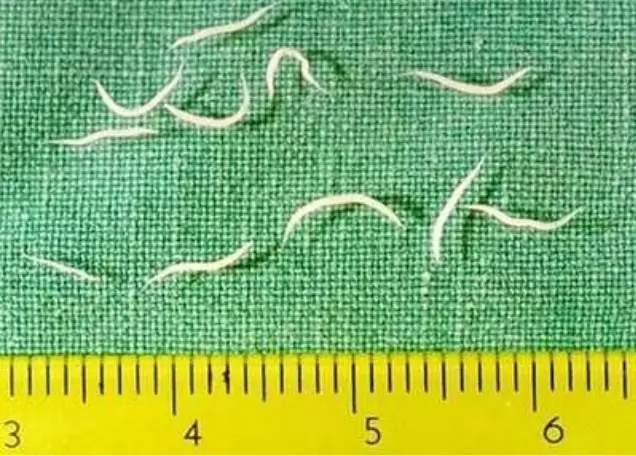 Coconut oil and apple cider vinegar for pinworms