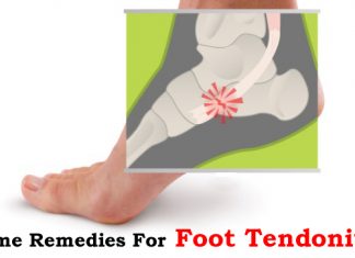 Home Remedies for Foot Tendonitis