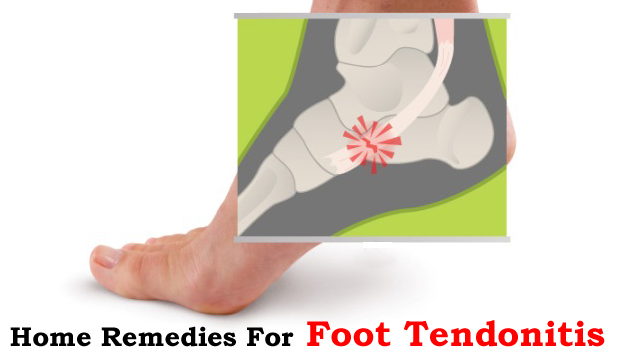 Home Remedies for Foot Tendonitis
