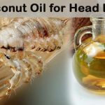 Home remedies for lice