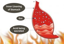 Natural cure for burning sensation in stomach