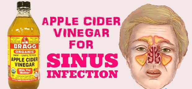 how to get rid of a sinus infection