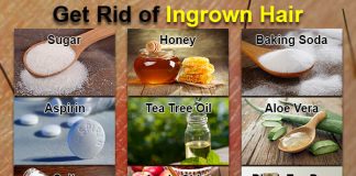 home remedies get rid of ingrown hair