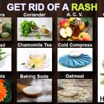 home remedies to get rid of a rash