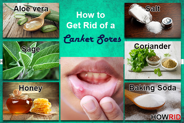 how to get rid of a canker sores in mouth