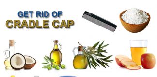 how to get rid of cradle cap