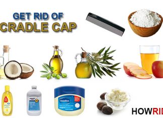 how to get rid of cradle cap