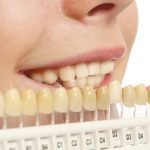 how to whiten teeth overnight