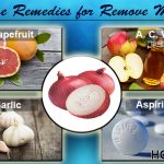 how to remove moles naturally with home remedies