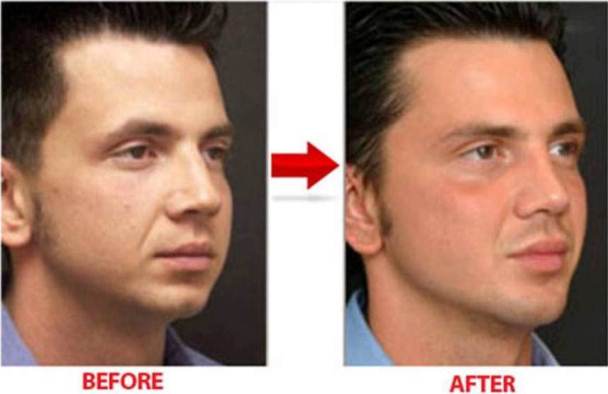 lose weight in your face