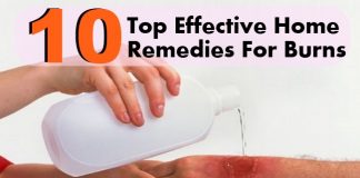 home remedies for burn