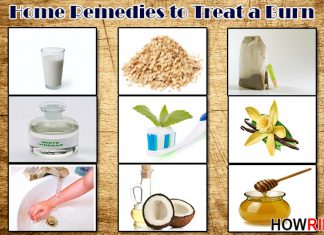 home remedies to treat a burn