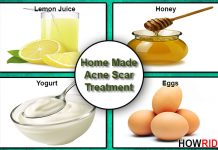 homemade acne scars treatment