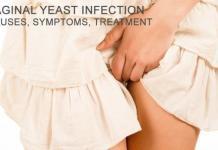 how to cure a yeast infection