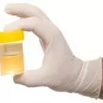 How to Pass a Urine Drug Test? how to pass a urine drug test