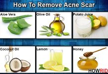 remedies to remove acne scars