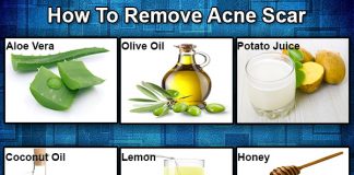 remedies to remove acne scars